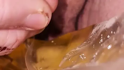 Sakat sorunları 101: İdrar kesem serbest bırakılamadığı için bir kateter kullanarak boşaltmam gerekiyor