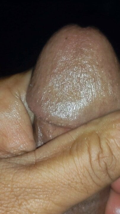 ماساژ اکتسابی. 