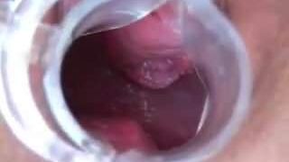 Wife has Speculum Orgasm Contractions 0:46