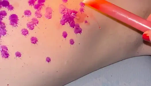 Duyusal Yoksunluk Bölüm 2