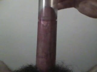 suction please