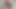 BEST OF TEENS FACIALS #1 HD 2018