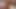 Anonym, Schlingenfick