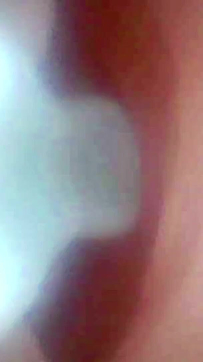 A detailed examination of Lopuza93 Vagina area using an endoscope camera. | Clip 1