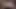 Girlfriend's step mom saved the guy from excessive penis erection