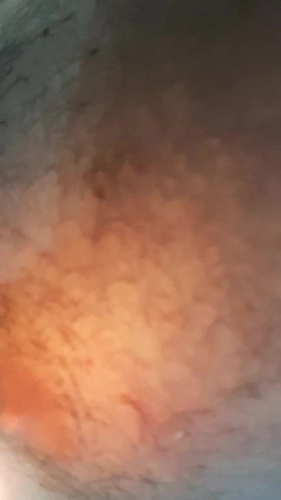 Burning my nipple every day task