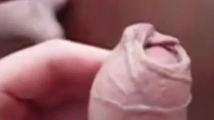 Cum in his very long foreskin