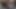 Lizzy Yum VR June 2023 PUSSY and ASS #1 post op orgasm pussy anal masturbation teasing orgasm