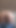 Muhteşem an "Tombul milf web kamerası üzerinde boşalan. bir yabancı için kıllı bir kedi parmak büyük göğüsler ile olgun bbw. pawg. amatör fetiş."