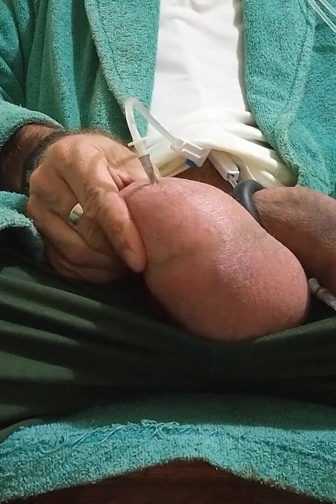 Saline di testis