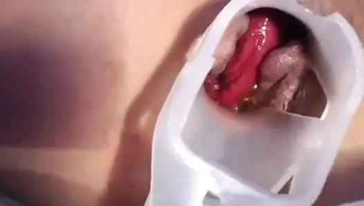 Anal speculum, pussy fuck and squirt HD