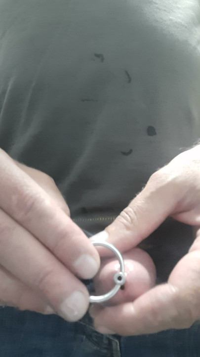 emptying through the dilator