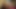 セドリカのランドリーディシプリン、ドリームガールズ・イン・ソックス