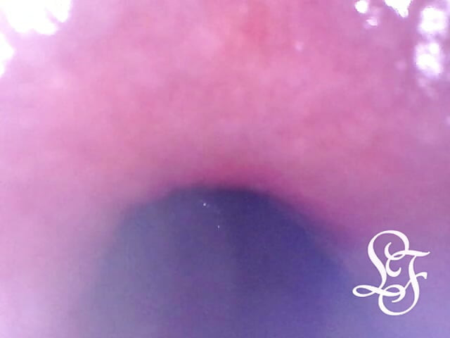 Exploring the Depths of my Ass with the Minicam!