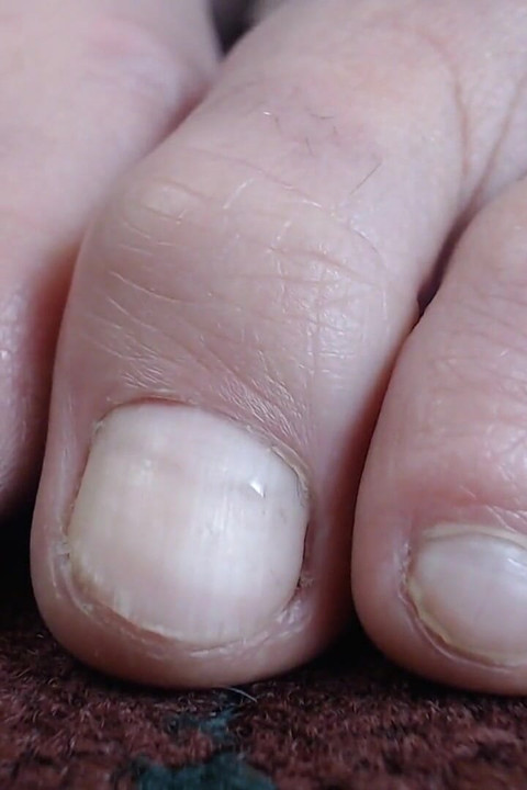 Natural toe closeup