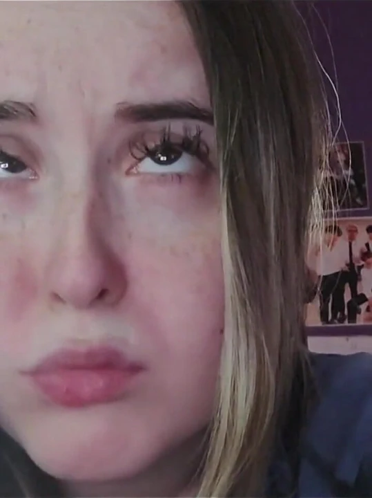 我看着你, 交叉眼睛