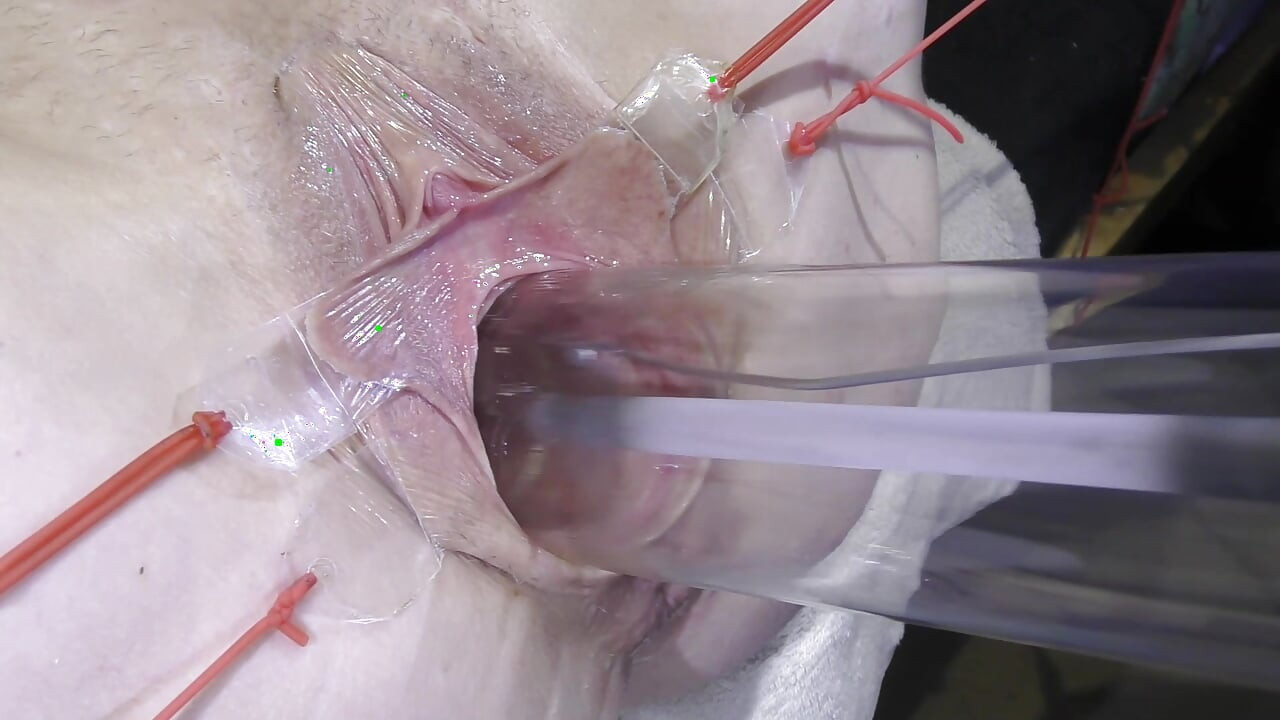 Rozchylona Cipka Z Bliska Pieprzynie Się Lampą 1000w