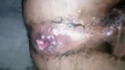 stretching a hole