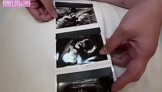 Masih mau luka bakar di waktu hamil 26 minggu? A J Cup Gravure Idol Berani Fantasi Seragam Mini Berisiko