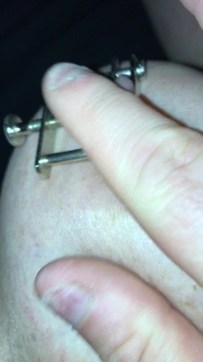 Amateur claw nipples