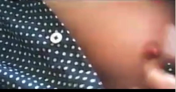 My Nipples