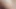 Angela attison ağrılı bbc anal