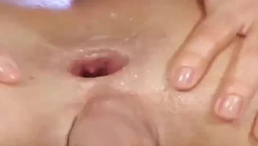 Both Holes Are Plugged