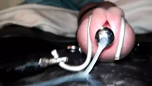 Estim penis tıkaç çekimi