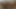 LizzyYum december 2023 (cuffed) Post Op Orgasm Pussy Masturbation Teasing