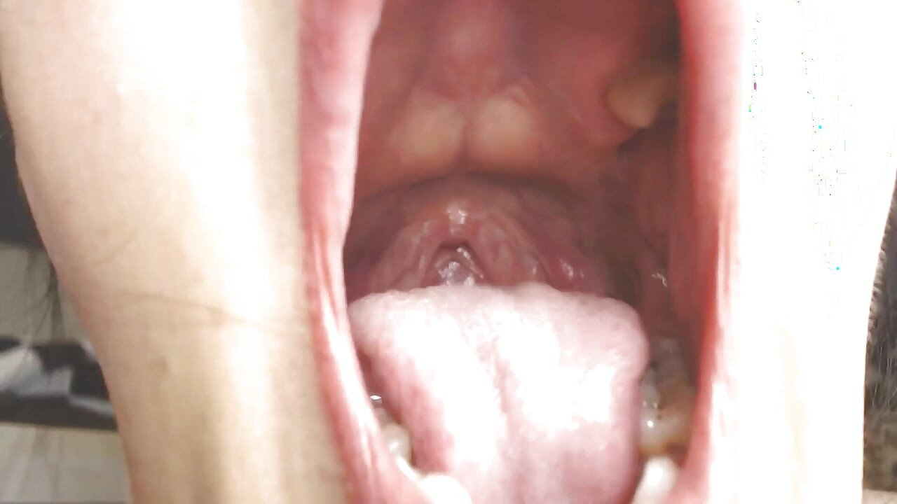 Uvula tonsils meludah tenggorokan dan mulut uvula