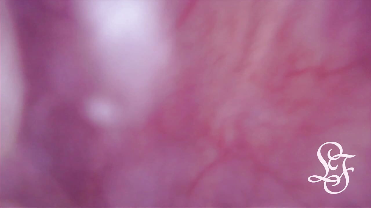 膀胱内突起 アナルから