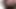 A MILF Girl Had Her Ass Stretched by a Man with a Very Large Penis.