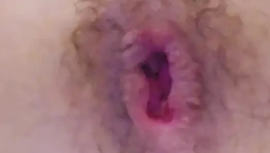 Working hard on my prolapse