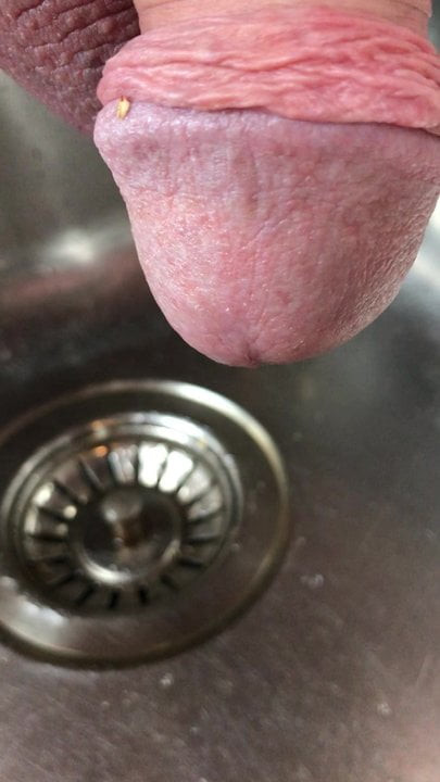 Pissing in the zink again