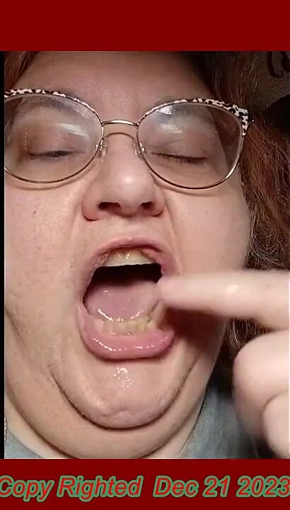 Requested Video Look Inside My Mouth