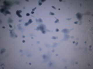 Orgasmo com dilatador, microscópio de esperma