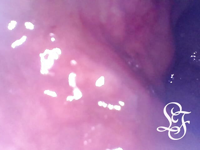 Exploring the Depths of my Ass with the Minicam!