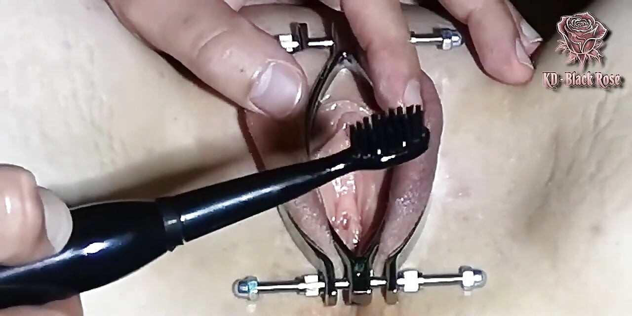 柴張