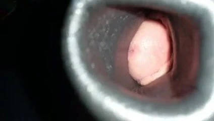 Sex