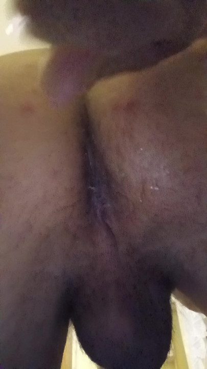 Morning anus