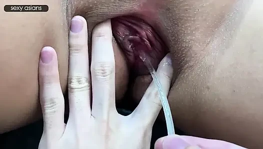 Intense Conception Quest - a Couple Pushing Limits for Their Shared Future