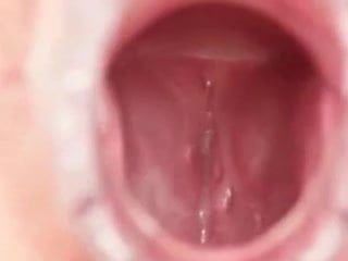 Secreción vaginal