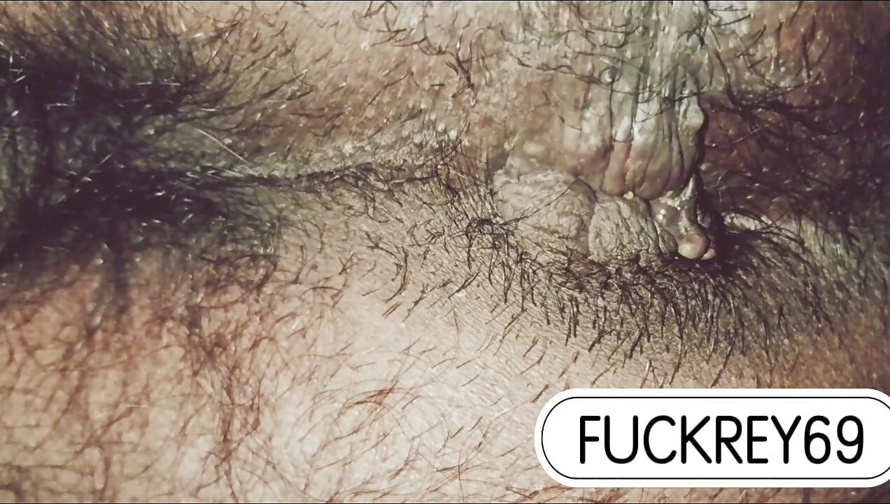 누구 내 엉덩이 가려움 좀 풀어줄 사람 없나 친구야 진짜 하고 싶다