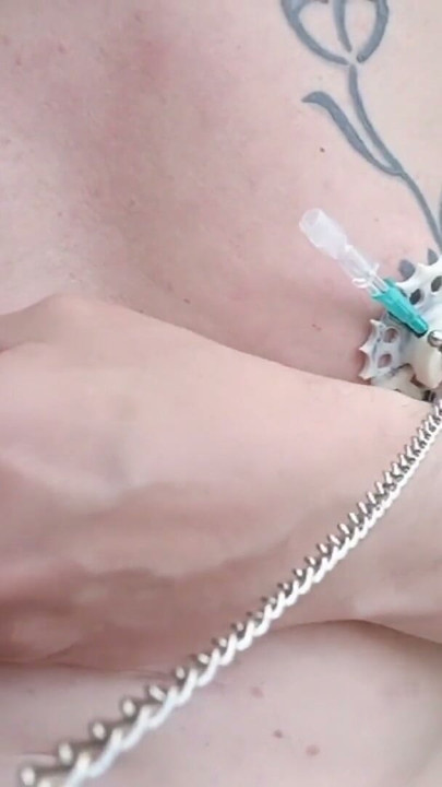 6 needles through the nipples stretched by plastic flower ring with holes on the terrace outside | Clip 1