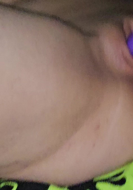 Minha diversão anal