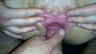 Половые губы растянуты