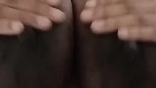 Engorged