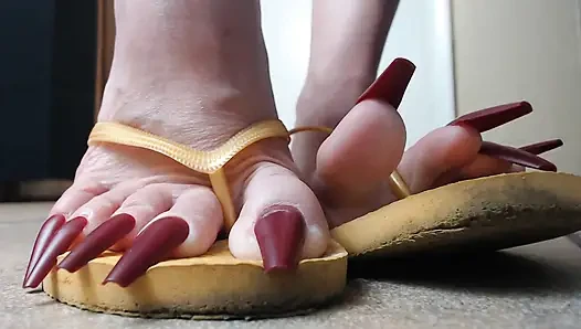 Toenails hanging off yellow flip flops