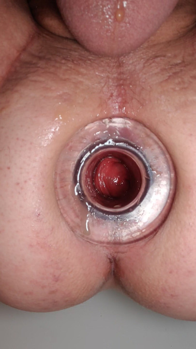 Anal