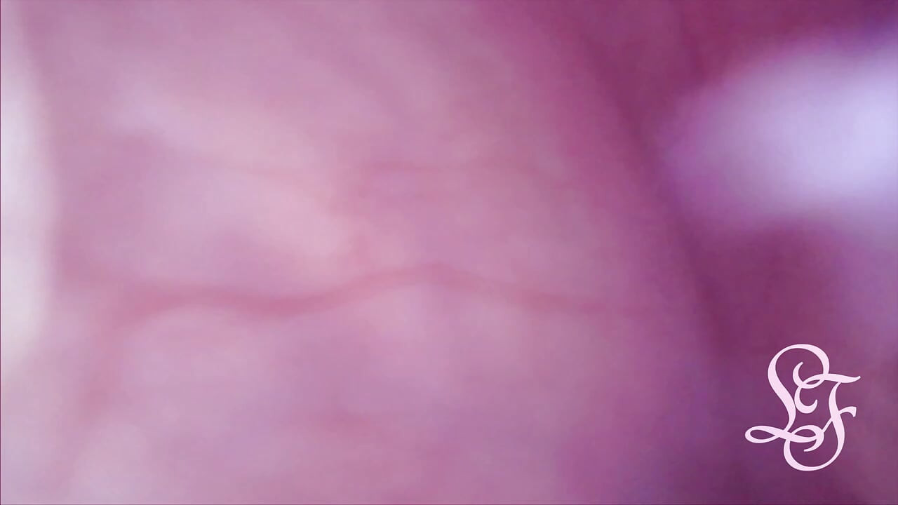 Beule IN meiner Blase durch Anal